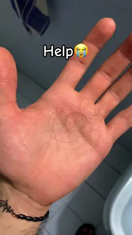 Day 254😖 #fyp #foryoupage #fyppppppppppppppppppppppp #foryou #tiktok #GlowUp #hairstyle #lglowbeauty #haircut #hair #hairloss #minoxidil #finasteride #rosemaryoil 