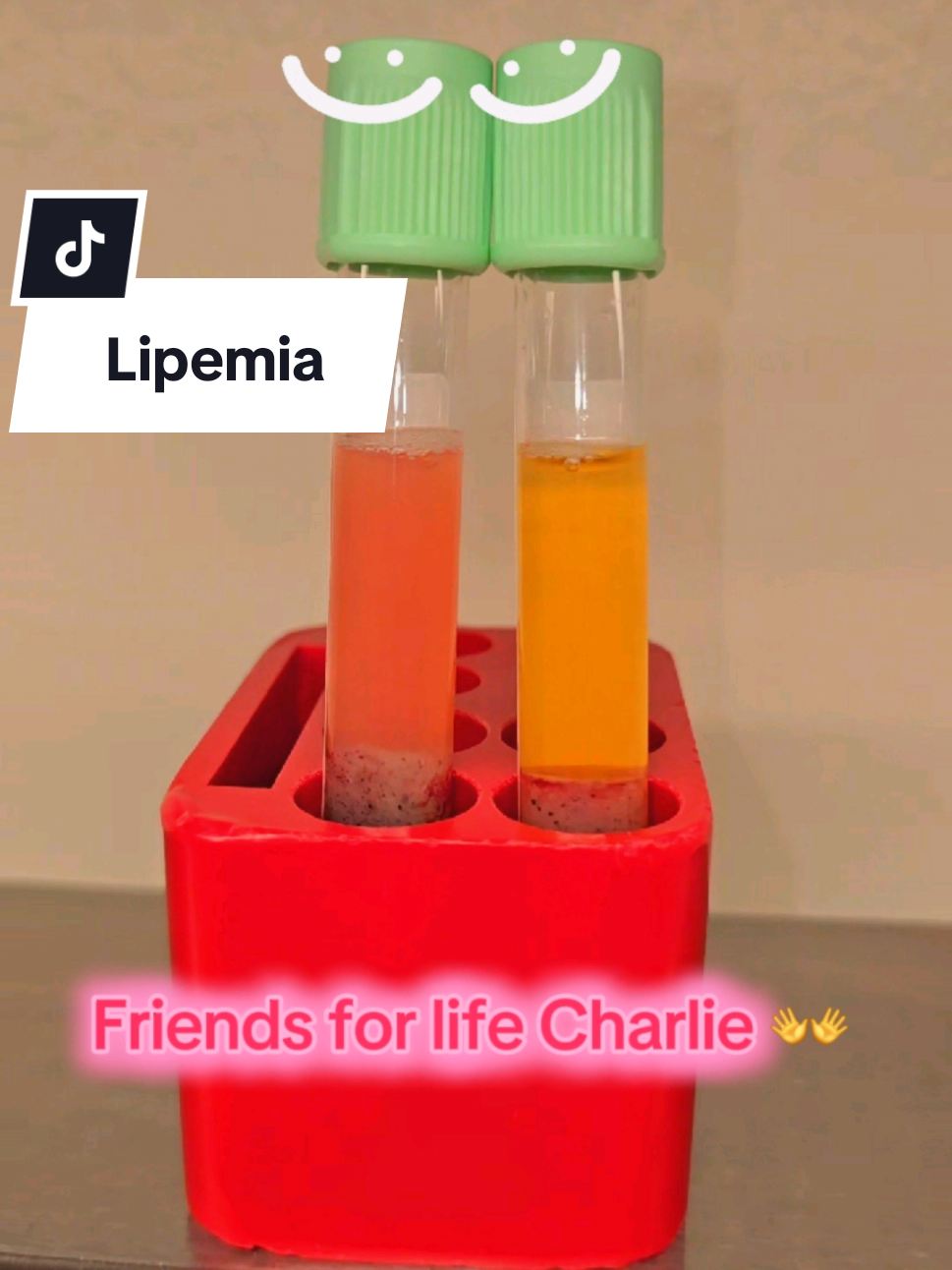 Cloudy plasma? It’s called lipemia. Techs might need to retest or alert the doc! High fat can mess with results!! Did you forget to fast? 🤔 #DayInTheLife #fyp #phlebotomy #phlebotomist #HealthcareWorker  #TikTokNurse #MedicalTikTok #HealthTok #LifeAsAPhlebotomist  #BehindTheLab #MedicalLife  #FYP #ForYouPage 