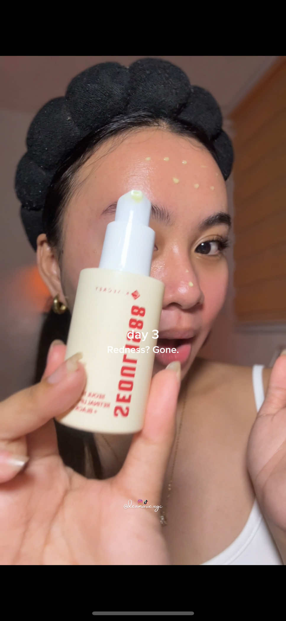 In just 7 days??🤯 I'm obsessed w this serum!! #skincare #skintok #kbeauty #koreanskincare #skincareroutine #10days #retinalserum #acneserum #poreserum #rednessserum #kbeauty #beauty #ugc #glowupwithretinalchallenge #ksecret #seoul1988 