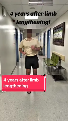 #giotikasclinic #drgiotikas  #limblengthening #patient #height #increase #taller #athens #greece #london #uk #nails #removal  #αυξηση #αναστηματος #ψηλοτερος #αθηνα #ελλαδα #CapCut 