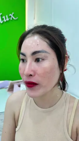 จบฝ้า ด้วยสมุนไพรไทยแท้ รีวิวปัญหาลูกค้าฝ้าฝังลึก ดูแลผิวโดยคุณเลย์-คุณฝ้าย คนสวย #ฝ้าหนา #ฝ้า #ผิวหมองคล้ํา #หน้าใส #สมุนไพร #ธรรมชาติ 