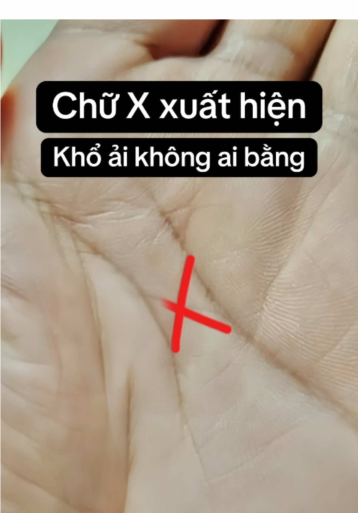 Dấu chữ X – không chỉ là một đường chỉ tay. Nó là tín hiệu của tiền kiếp và vận số hiện đời.” •	#xemchitay #xemchitaymienphi #xemchitayonline #xemboi #xemboituvi #xh #xhtiktok #vanmenhradio #vậnmệnhradio 