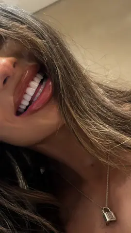 Couldn’t possible recommend @Serinsey Smile Dental Clinic more🦷💎🌟  #serinsey #serinseyturkey #serinseysmile #turkey #istanbul #compositebonding #turkeyteeth #zicroniacrowns #veneers 