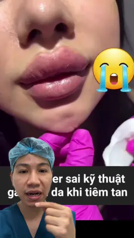 Mất cằm luôn rồi! #bsthechuyen #phauthuatthammy #bienchungthammy #filler #botox #doncam #nangmui #gheptrungbi #nangmuidatsong #lamdep 