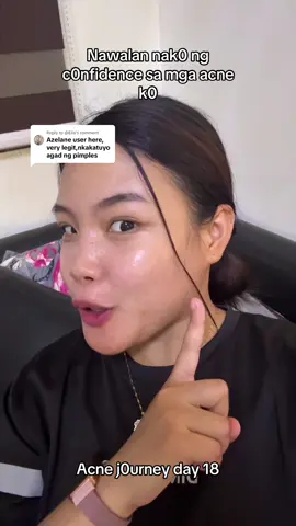 Replying to @@Ella Dėrma tésted soap. Acne Journey using Azelane soap #azelanesoap 