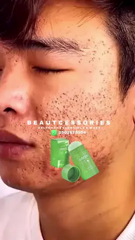 Meidian Green Mask Stick Price: 70ghc  Call/Whatsapp 0502675954 to order  #greenmaskstick #greenmaskstickreview #skincareviral #beautcessories #ghanatiktok🇬🇭 #ghanatiktokers🇬🇭 #nigeriantiktok🇳🇬 