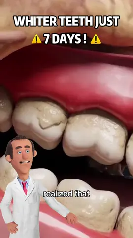 Smile care hack!!!🤕🤡👀#usa #teeth #oral #viralvideo #teethwhitening #teethwhitening #teethcleaning #braces #stroy #dentist #knowledge #pov #fyp #usaus #toothpaste #rootcanal #or #on #healthy #badbreath #roomdecor #real #cozyvibes #effortlessbeauty 