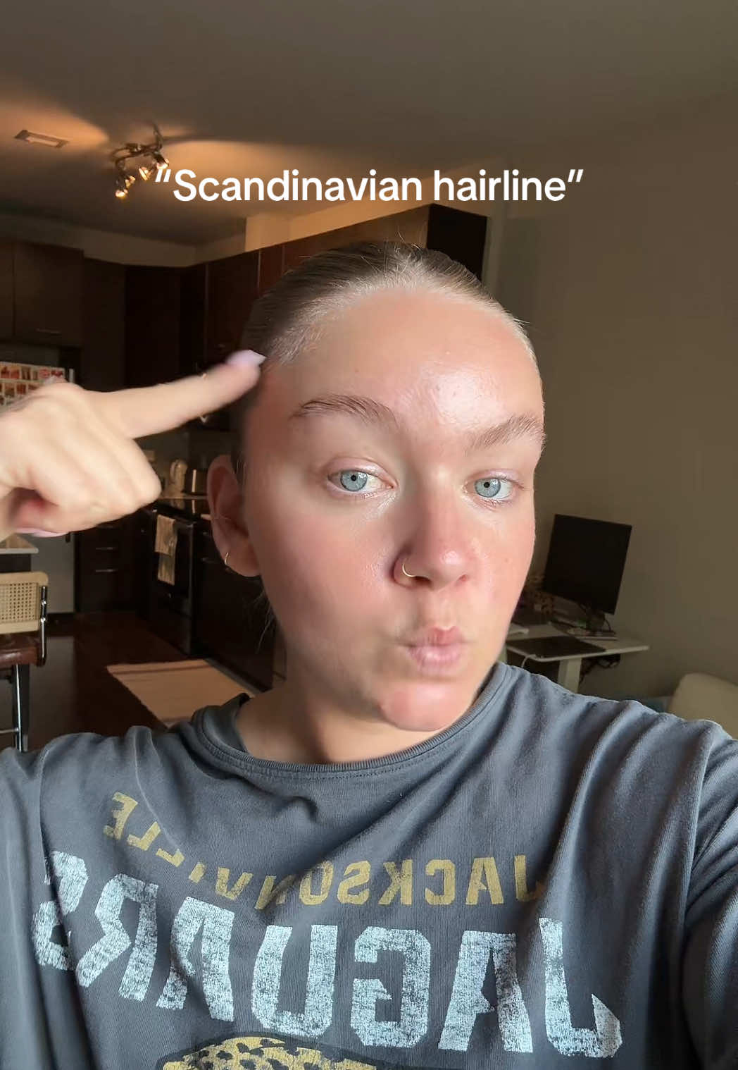 Probably gonna delete this but STOP ASKING TO LOOK BALD