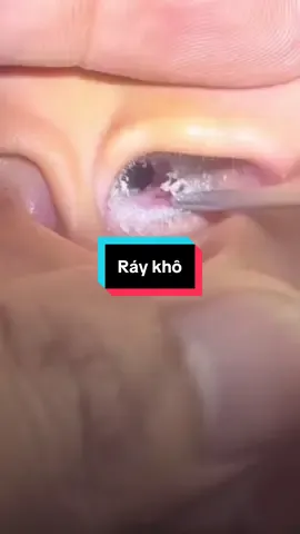 Ráy khô #raytai #xuhuong 
