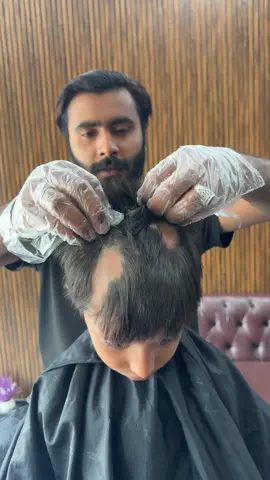J J hair saloon#trendingvideos #foryourpa #foryourpages #naturalalopeciatreatment #foryoupageofficiall❤️❤️tiktok2024🙏💯🍀 #alopecia_treatment_results #jjbro41 