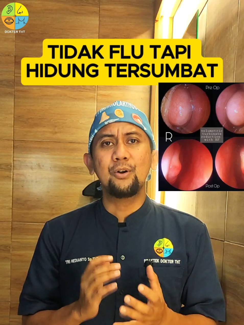 ⚠️BACA CAPTION⚠️ ⬇️⬇️⬇️ 👃🏻 “Hidung tersumbat tapi nggak pilek?” Buang ingus tapi ga keluar lendirnya 😤 Jangan di terusin ya, nanti mimisan,  Kesumbatnya mungkin bukan karena flu… tapi karena konka hidung yang membesar! 😱 📌 Apa sih konka itu? Konka (atau turbinate) adalah struktur di dalam hidung yang fungsinya bantu mengatur suhu & kelembapan udara yang kita hirup. Tapi saat konka membesar karena alergi, udara dingin, iritasi kronis, atau pembuluh darah melebar, hasilnya: ✅ Hidung tersumbat ✅ Napas dari hidung jadi berat ✅ Tapi... nggak ada ingus sama sekali! 🔍 Ciri khasnya? ✅ Tersumbat bergantian kanan & kiri ✅ Sering makin parah saat malam hari ✅ Nggak sembuh-sembuh meski minum obat flu 💡 Solusinya? 🔸 Obat semprot anti-inflamasi 🔸 Kontrol alergi & iritasi 🔸 Kalau parah, bisa dilakukan radiofrekuensi atau reduksi konka oleh dokter THT Jadi... kalau kamu sering ngerasa hidung tersumbat tapi nggak pilek-pilek, 👉 jangan anggap remeh,! bisa jadi itu hipertrofi konka. 📍 Periksa ke dokter THT biar napasmu lega lagi! #HidungTersumbat #KonkaHidung #DokterTHT #EdukasiKesehatan #trihedianto #THTSurabaya #rinitis 
