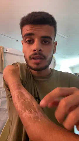 Save Mahmoud and his hand ‏#fyp #fup #viral #foryoupage #govirall #fypsy #fypg #fyyyp #frp #kids #business #fyyy #f #fyp #foryou ##foryoupage #fypppppppppppppppppppppppppppppppppp #viral #water #Home #food #job #usa #indonesia #dubai🇦🇪 #unfrezzmyaccount #support_me #dubaichocolate #foryou #fypシ #foryoupage #viralvideo #trend #explore #Love #support #helpme #life #family #saveus #tiktok_arab #palestine #rebuild #hope #future #dubai #usa #indonesia #tiktok #tiktokviral #fypdaily #momlife #baby #reallife #savelives #war #refugees #recovery #motherhood #voice #gaza #prayforus #helpnow #emergency #humanity #peace #rebuildhope