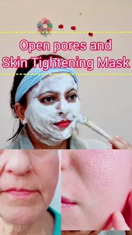 Close open pores and tight your skin naturally at home with two simple ingredients.  Best remedy for tighten face skin and close your pores, First application the result will surprise. #skintighten #tightyourskin #openpores #openporesremedy #naturalbeauty #naturalremedy #looseskin #eggmask #milkmask #eggandmilk #porecare #porecaretreatment #closepores #freshskin #porecare #poremask #DIY #facemaskdiy #antiagingmask #poreminimizer #beauty #beautytips #beautyhack #glow #GlowUp #glow #skincarehack #beforeandafter #viralmask #TikTokBeauty #beautytoks #openporesproblem #openporesremedy #goviral #goviralgo #foru #forum #foruyou #fory #foryoupage❤️❤️ #foryour #sofiafromgermany #sofia #explore #instareel #europe #asian #denmark #norway #ireland #ukpunjabi #usaindian #kuwait #dubai #swiss #indiantiktok #india #pakistan #nepal #bangladesh #spainpunjabi #indianinspain #itlaypunjabi #france #beligum #germany #desi #hindi #urdu #mainz #frankfurt #berlin #tiktokbeauty #turkey #ukraine #romania #cloggedpores #