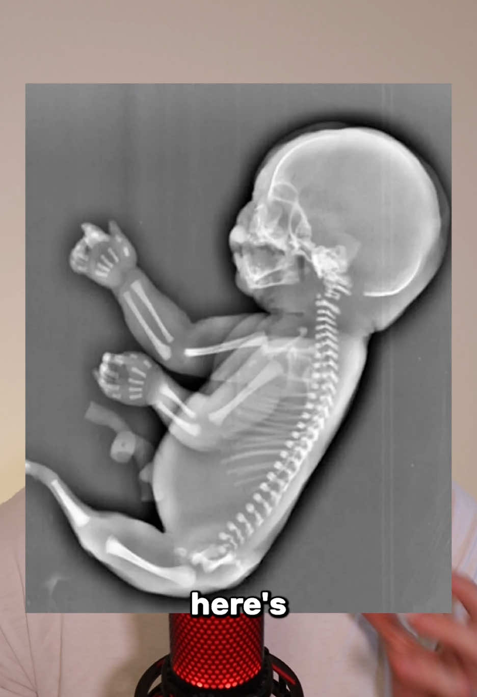 You’ve born with a tail! #science 