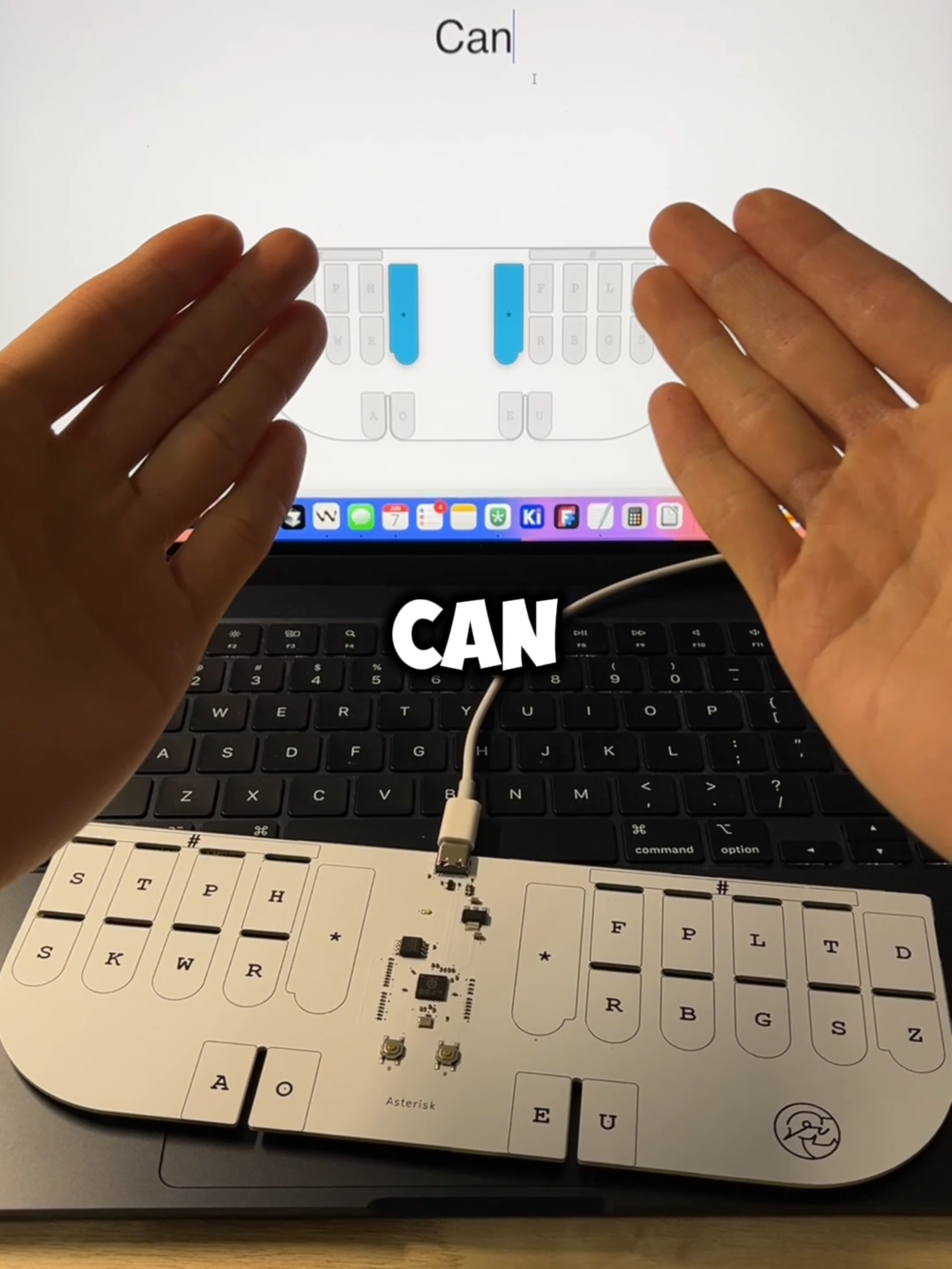 Can