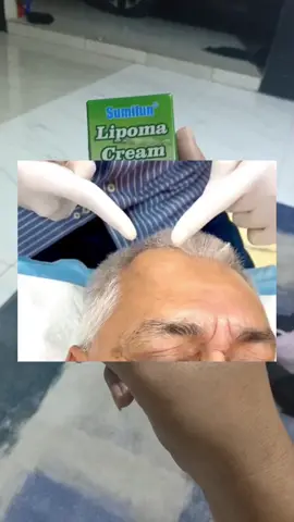 promo khusus salep lipoma cream #salepbenjolan #salepbenjolanlipoma #lipoma 