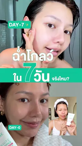 ผลลัพธ์ 7 วัน โฟมล้างหน้าพี่หลิง หลังใช้คือ ทับใจมากค่ะสาว ใครอยากผิวกระจ่างใสแบบไม่ต้องไปคลินิก ไปลองค่ะ เริ่ด! 🧼✨🧖🏻‍♀️ #SmoothExLingOrm #โฟมพี่หลิง #โฟมที่หลิงเลิฟ #LingOrmSmoothEfamily #SmoothEpH5 #SmoothE #สมูทอี