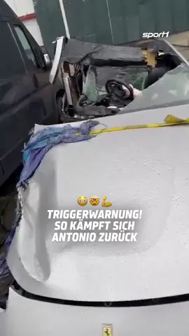 Letztes Jahr geriet West-Ham-Stürmer Michail Antonio in einen schweren Verkehrsunfall. Seitdem arbeitet er unaufhörlich an seiner Rückkehr. Großer Respekt und gute Besserung! 🙏 #sport1 #sport1news #westham #antonio