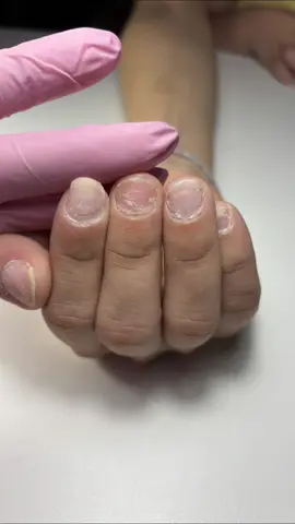 ✨ Antes y Después de un Set de Uñas Acrílicas + Curso GRATIS en YouTube 💅 ¿Te gustó este cambio? ¡Imagina aprender a hacerlo tú misma! 🔥 Este es solo un ejemplo de lo que puedes lograr con las técnicas que enseñaré en mi curso gratuito de uñas acrílicas esta semana por YouTube 🎥📚 📅 Reserva la fecha y suscríbete al canal para no perdértelo 📲 Enlace al curso en mi bio o escríbeme “CURSO” por DM para más info 💥 Aprende a aplicar, esculpir y diseñar uñas acrílicas desde cero. #CursoDeUñasAcrílicasGratis #AntesYDespuesUñasAcrílicas #UñasAcrílicas #TransformaciónDeUñas #NailArtEducación #CursoGratisDeUñas #NailsBeforeAndAfter #AcrylicNailsTutorial