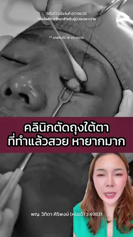คลินิกที่ตัดถุงใต้ตาแล้วสวย หายากนะเพราะแบบนี้ ลองมาฟัง  #ศัลยกรรม #ตัดถุงใต้ตา #ตัดถุงใต้ตาที่ไหนดี #ตัดถุงไขมันใต้ตา #tiktokuni #fyp #fypage #fyppppppppppppppppppppppp 