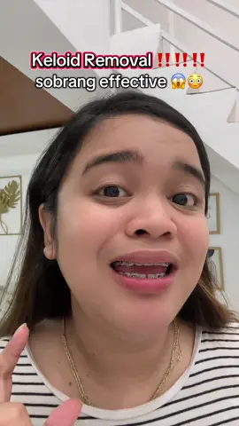 Sobrang effective Keloid Removal! 😳😱 Grabe nag-flat na yung Keloid kooo! 😭😭😭 #keloid #keloidremoval 