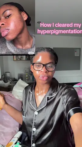 This is everything I used on my face for my hyperpigmentation, to be honest you see that Medicube pad, catch it !! #skincare #hyperpigmentation 