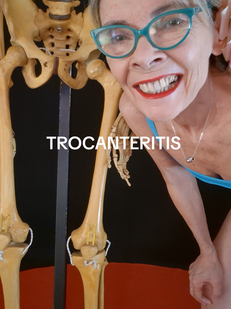 Trocanteritis  #traumatologia #terapiafísica #danza #fit #fitnessmujer #gimnasia #gym #verler #deportes #veronicalercari #gimnasiamujer #gimnasiaverler #kinesiologia #fisioterapia #kiné #yoga #pilates 