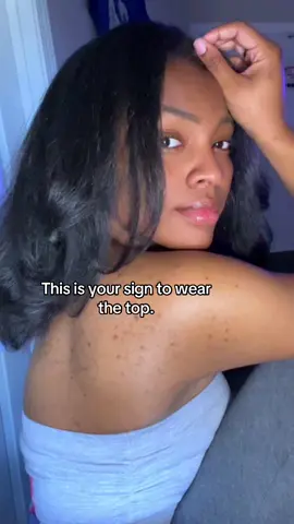 People will forget about your skin faster than you do, don’t let your insecurities keep you from showing up at your most confident. Wear the top sis. 💕 #backacne #acnejourney #theonlykaylalastar #acne #SkinStruggles #BodyAcneJourney #AcneIsNormal #BacneAwareness #SkincareJourney 
