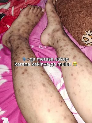 Sebab sabun sulfur mite nih lah，habis hilang segala badan kemerahanaku lega dan reda tau ！ly