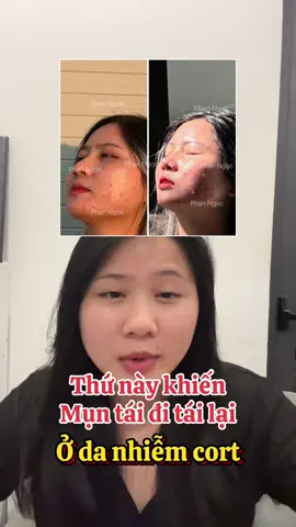 Thứ này khiến da nhiễm cort bị mụn tái đi tái lại #danhiemcorticoid #dieutrimun #mun #chamsocda #dieutrida #dieutridakhoahoc #corticoid #munviem #mundo 