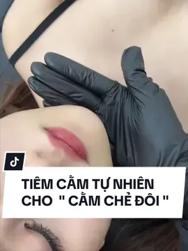 Tiêm cằm tự nhiên là như thế nào ? #tiemcam #tiemcamdanang #fillerdanang #phuongtodebeauté 