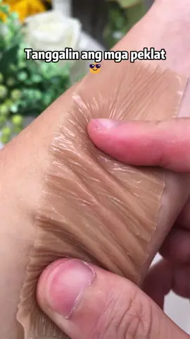 #TikTok #tiktokindia #tiktokviral #acne #patch #foryou #scar #tiktok 