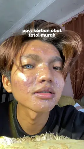 berpulu pulu dulu, glowing kemudian🤙🏻 #reels #page #explorepage #acnespot #totoljerawat #acnetreatment #acnecare #fyp