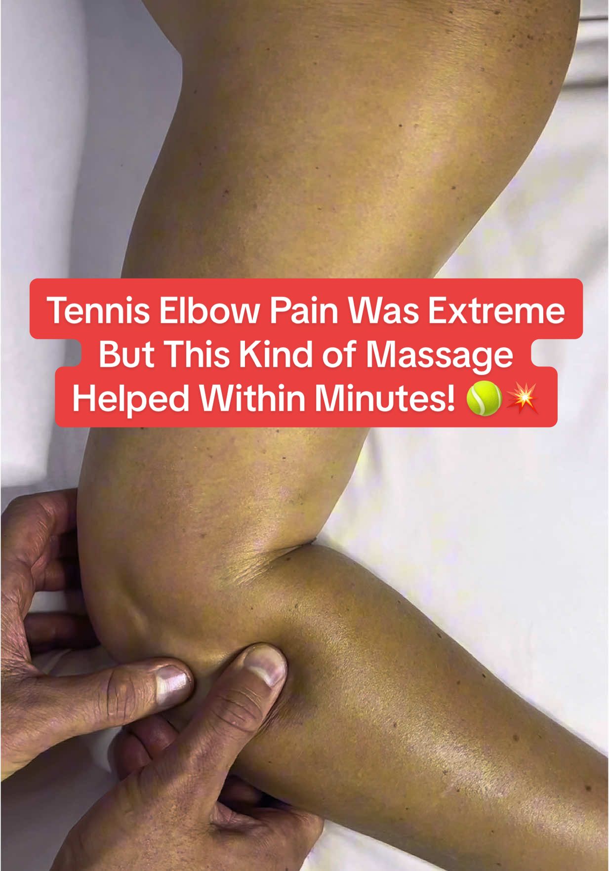 Tennis Elbow Pain Was Extreme—But This Kind of Massage Helped Within Minutes! 🎾💥 If you’ve ever had that burning, stabbing pain in your elbow… Picking up a bag hurts. Turning a doorknob hurts. Even holding your phone hurts. That’s tennis elbow—and it’s brutal. But here’s the good news: This isn’t just massage—it’s targeted kinesiology-based therapy that works fast. 💪 Releasing fascia 💥 Resetting overloaded muscles 🌿 Calming nerve inflammation 🔥 Improving blood flow and cellular repair Within minutes, most clients say: “It feels lighter. The pain’s already going down.” We’re not treating symptoms—we’re reprogramming the cause #T#TennisElbowReliefE#ElbowPainGoneM#MassageThatHealsK#KinesiologyMassageP#PainFreeElbowI#InflammationReliefF#FastPainReliefJ#JointRecoveryT#TargetedTherapyK#KinezioAdvancedMassageN#NaturalHealingD#DeepReliefMassageFunctionalRecovery #tenniselbow 