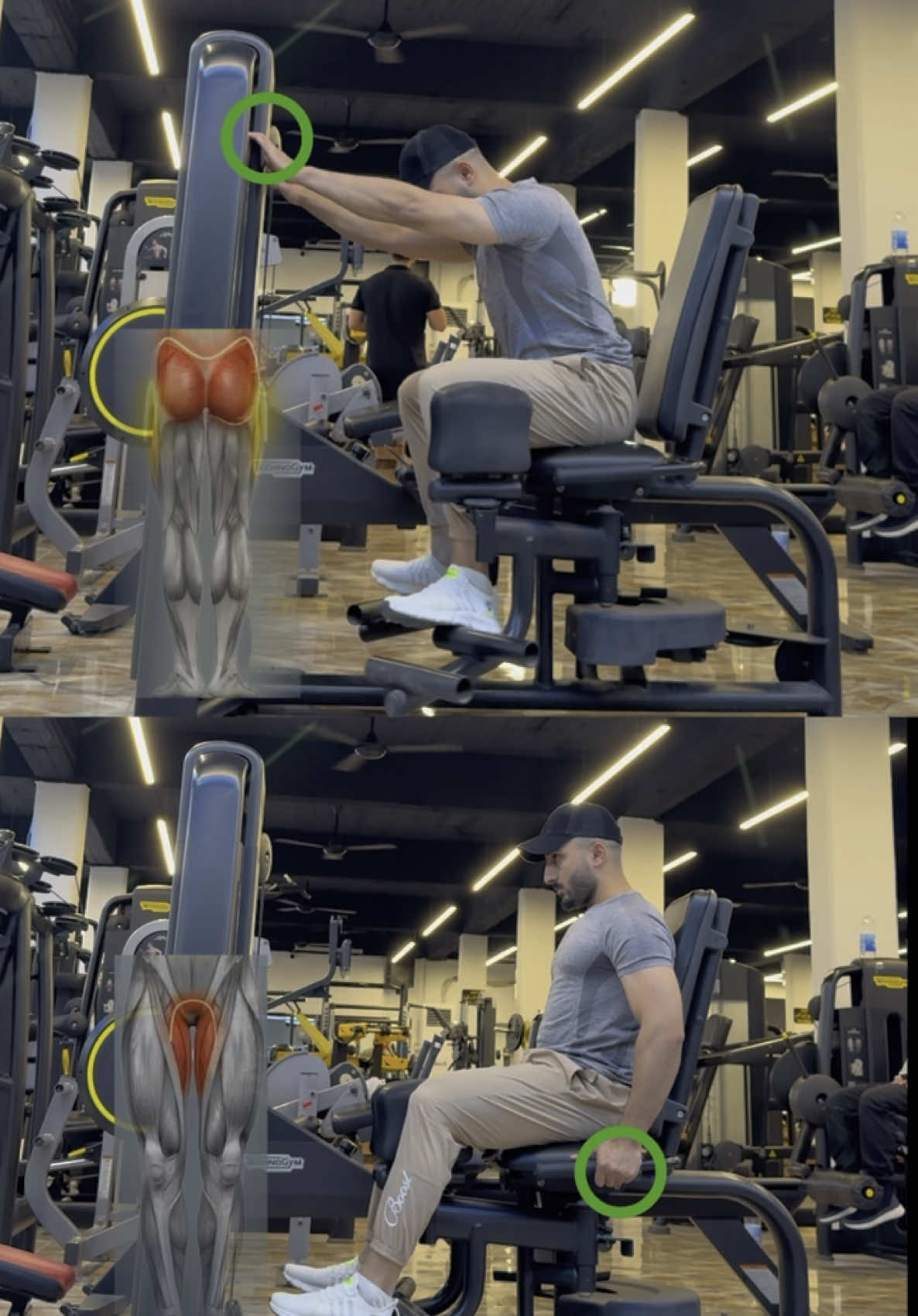 تمرين بجهاز Adductor/Abductor Machine — وهو جهاز مزدوج يُستخدم  لأداء تمارين عضلات الفخذ الداخلية (Adductors) وعضلات الورك والمؤخرة الجانبية (Abductors) عند استخدامه كـ Adductor: 	•تقوية العضلات الضامة (فخذ داخلي) 	•تحسين توازن الحوض 	•شد الفخذين من الداخل 	•مناسب للنساء والرجال 🔹 عند استخدامه كـ Abductor: 	•نحت وتكوير المؤخرة (glutes medius & minimus) 	•تحسين الاستقرار في الحوض والركبة 	•دعم أداء تمارين مثل السكوات والجري —————————————— #foryoupage #foryou #trending #viralvideo #اكسبلور #رياضه #الشعب_الصيني_ماله_حل😂😂 