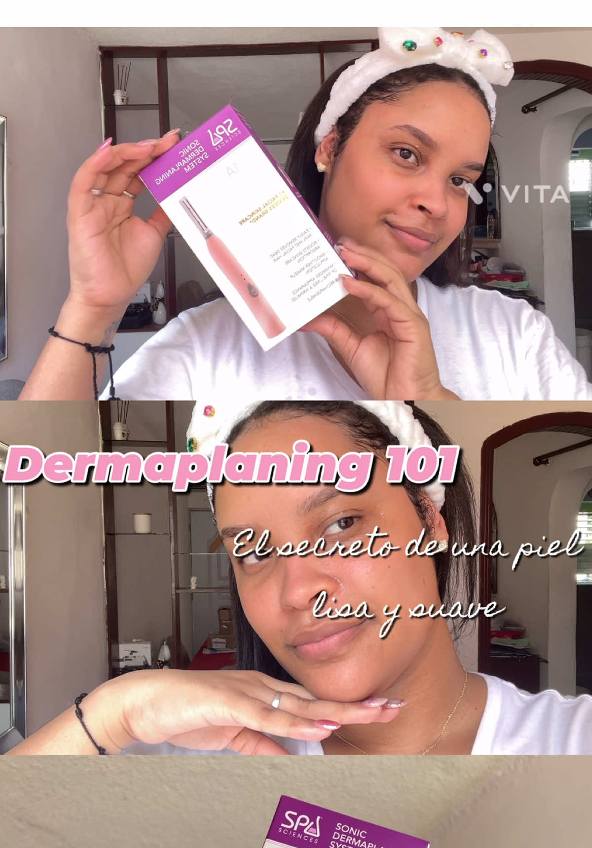 Nunca subestimes el poder del dermaplaning 🪒✨. Remueve las células muertas y deja la piel lista para absorber todo tu skincare 💧.  ¡Desde que lo hago, el glow es REAL! 😍 ¿Ya lo probaste?  #creatorsearchinsights #dermaplanning #skincaretips #glassskin #dermaplaningtutorial #dermaplaning @Spa Sciences 