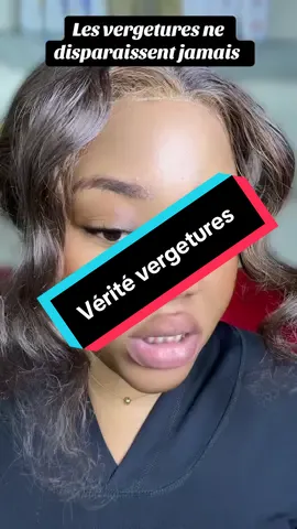 #skincarebenin #beutyroutine #produitmiracle #avantapres #vergetures #traitement 