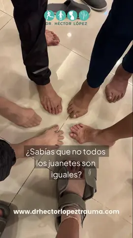 🎥 ¿Juanete o algo más? Descubre la verdad sobre esa “bolita” en tu pie 👣 Muchas personas piensan que el juanete es solo un problema estético, pero en realidad puede afectar tu forma de caminar y causar mucho dolor. En Balance Orthopedics te ayudamos a entender qué está pasando en tu pie y qué tipo de tratamiento es el mejor para ti.  Ya sea con plantillas, ejercicios, manejo del dolor o cirugía, estás en manos de un traumatólogo con experiencia.   #Medicina #Juanete #DolorDePie #Dolor #Pie #Tobillo #CirugiaDeJuanetes #CirugiaMonterrey #JuanetesMexico #Juanetes #Cirugia #Salud #Bienestar #FootCare #ParaTi #FYP #Ortopedia #Traumatología