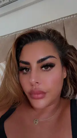 I’m booking turkey for a hair transplant as we speak 😂🤣