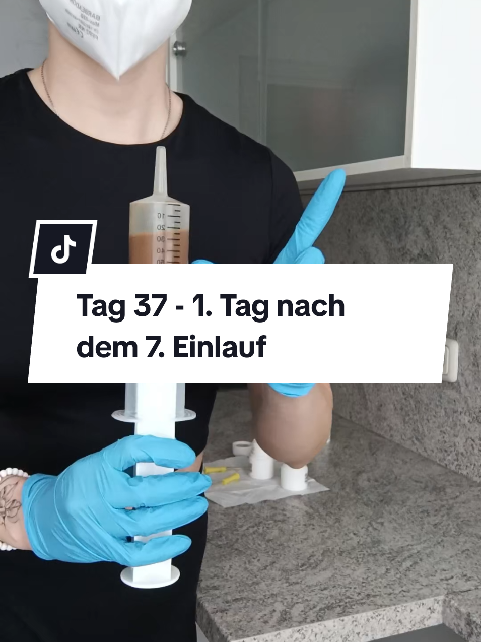 1. Tag nach meinem zweiten Einlauf mit 100ml und ich kann sagen es geht mir damit besser als mit 50 ml #stuhltransplantation #fmt #dysbiose #blähbauch 