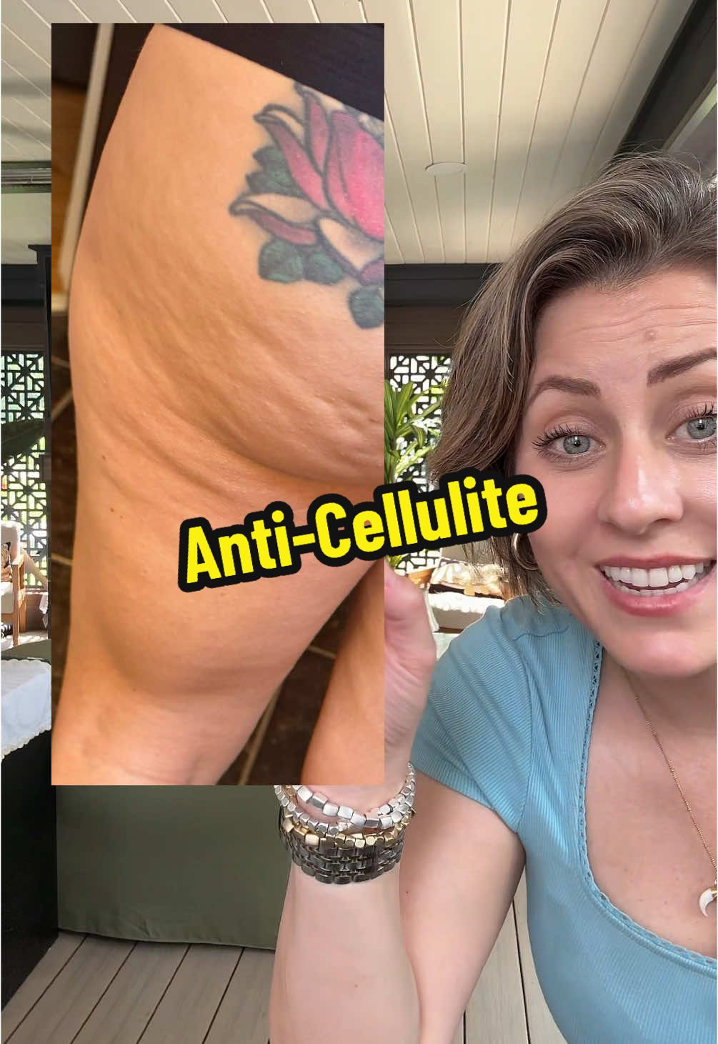 🧴I’ve never snatched up a product so frickn fast! Bye bye cellulite !  #tiktokshopsummerturnup #tiktokshopcreatorpicks #cellulite #anticellulite #stretchmarks #celluliteoil #m3naturals 