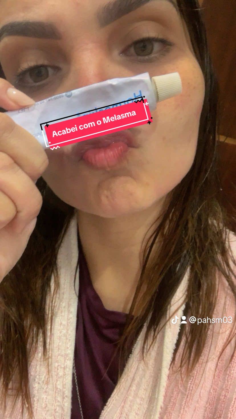 Tratando melasma em casa 😚 #fyp #melasma #acidohialuronico #melasmatreatment #manchasnapele #f 