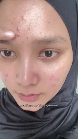 Best affordable acne lotions🥹 #obattotoljerawatg2g #obattotolviral 