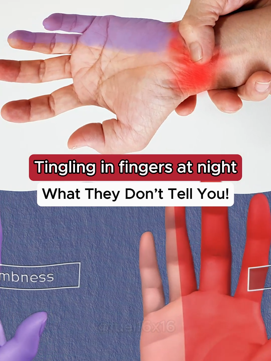 Tingling in fingers at night: what you need yo know!.. #tingling #fingers #pain #healthtips #cause #medical #signs #medicine #symptoms #hospital #3d 