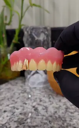 Upper Full Denture 🦷🤹🏻‍♂️💎✨️