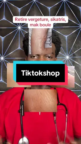 Retire vergeture, sikatris sou po w jere tèt ou!! #tiktokshop #pourtoi #tiktokshopaffiliate #tiktokshopsummersale #fyp  #tiktokshopsummerturnup  #summersales #ttshop #scarremoval  #scar #acne 