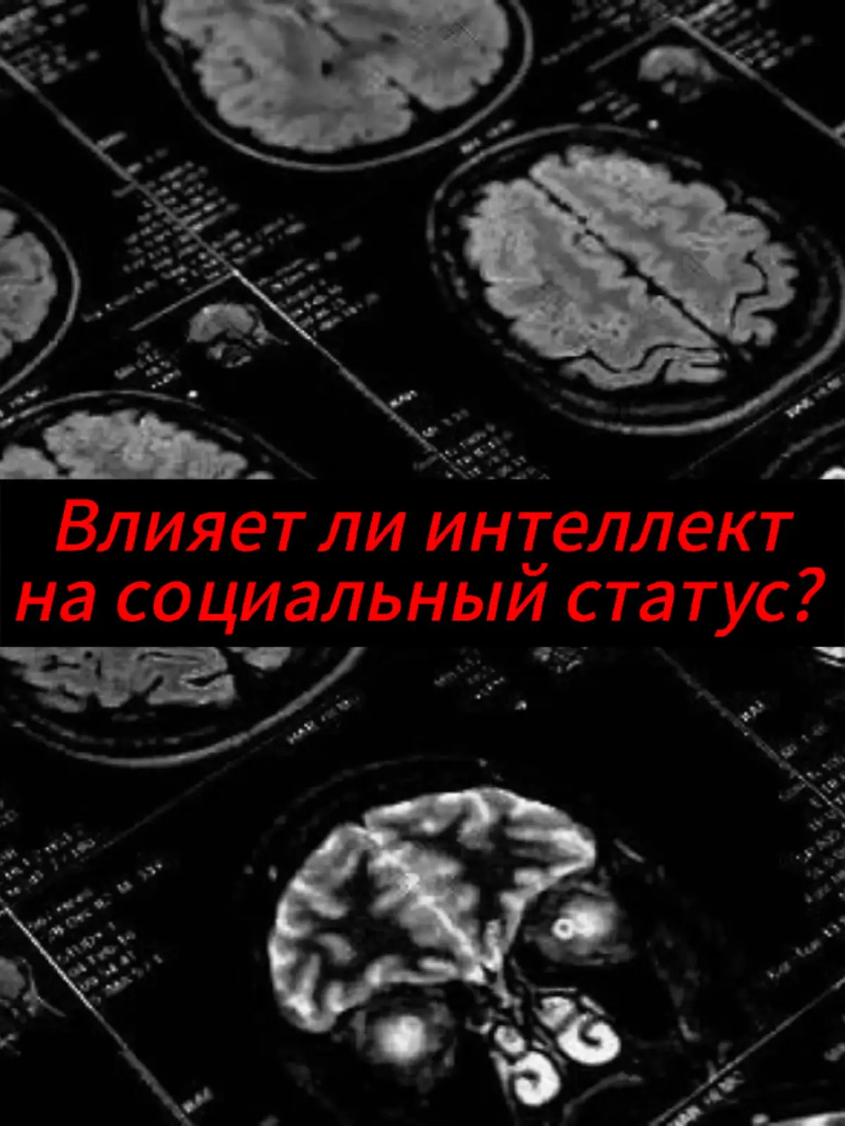 Если рассуждать о значимости тех или иных качеств, то надо принять такую установку: любое общение — это гормональная транзакция. Люди ждут от вас способности дарить серотонин, окситоцин, дофамин; если вы справляетесь с этой задачей, то только тогда получаете что-то взамен. К чему я это говорю? К тому, что этот тезис аннулирует спор между харизмой и внешностью, прекращает арбитраж блюпилла с блэкпиллом. Люди обогащаются дофамином, когда смотрят на красивое лицо — и делают то же самое, когда внимают хорошо поставленной речи. Таким образом, гормональные якоря — это универсальная валюта в общении; и вопрос лишь в том, какие номиналы у вас есть. 📌 Для примера возьмём двух людей: первый обыкновенной наружности (5/10), но с интеллектом чуть выше среднего. Второй — симпатичный внешне (6/10), однако обременённый критически слабым умом. Здесь первый человек имеет неоспоримое преимущество, потому что способен дать окружающим больше эмоциональных выгод (допустим, своей находчивостью и тактом). 📌 Возьмём второй пример. Есть тот же человек (5/10, однако чуть выше среднего умом) — и рядом с ним объявляется некто обыкновенный по интеллекту, но при этом экстремально красивый.  Согласитесь: в этой ситуации конкуренция проёбана, потому что ординарное преимущество (интеллект чуть выше среднего) сталкивается с внешностью, которая (в бытовой обстановке) аналогов иметь не будет. *** Причём заметьте, что здесь нет ничего несправедливого. Быть красивым — это почти то же самое, что сделать окружающим подарок; мы говорим об осязаемой возможности строить чью-то радость. Представьте, что девушкам приятно с вами фотографироваться (потому что это косвенно повышает их статус), а также свидание с вами — это буквально возможность похвастаться. Может ли ум смоделировать тот же эффект? В редких случаях да. Уточнить хочу лишь вот что. Для восприятия красоты не требуется ничего, кроме лимбической системы; тогда как оценить развитый интеллект может лишь тот, кто обладает сравнимым достоинством. Таким образом, умный человек — это как частота радио, для которой у большинства не найдётся приёмников. #интеллект #социалка #саморазвитие #образование #мышление #нейропсихология  #общение #iq #внешность #лукизм #бп #гормоны #психология #ум #bp 