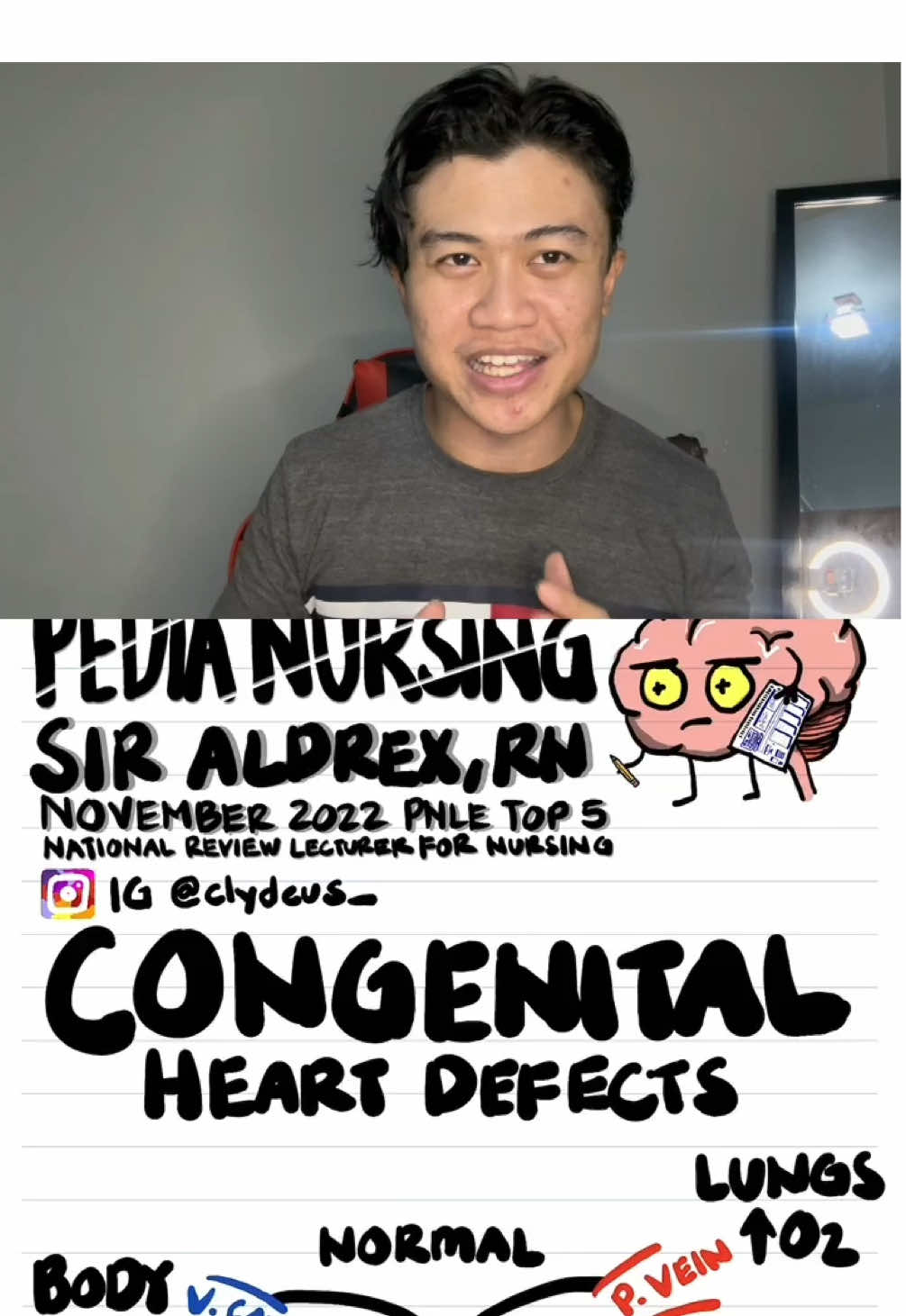 Congenital Heart Defect Primer. Discussing the normal extrauterine circulation and different shunts. Hi, I am sir Aldrex, your topnotcher-lecturer! Let’s make Med-Surg concepts simple! Follow for more: @clydeus_ on Instagram #fyp #fypシ゚ #nursingstudent #foryou #nle #rn #pnle #nursing #medsurg #review #lecture #nursingreview #medicine #NursingSchool #nursetok #RN2025 #RN #boardexam #heart #pedia #shunt #tof #tetralogy #tetralogyoffallot #ventricularseptaldefect #vsd #cyanotic #acyanotic 