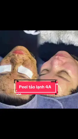 🌸Peel tảo lạnh 4A không bong🌸Làm sạch sâu-Tái tạo da-Cân bằng dầu #peeltao4a #oanhmeow96 