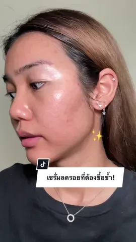 สกินแคร์ตัวจบ! ได้ทั้งลดรอยสิว+ให้ความชุ่มชื้น คนเป็นสิวผิวมันต้องรักแน่นอน  #รีวิวบิวตี้ #สกินแคร์ #รีวิว #รีวิวสกินแคร์ #สิว #รอยสิว #สิวหาย #skincare #axisy #axisydarkspotserum 